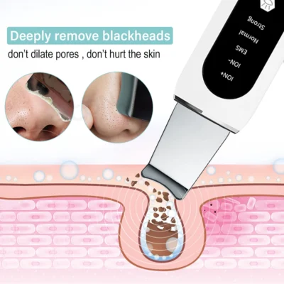 Ultrasonic Skin Scrubber Peeling Blackhead Remover Deep Face Cleaning Ultrasonic Ion Ance Pore Cleaner Facial Shovel Cleanser 4