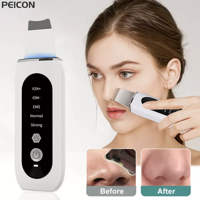 Ultrasonic Skin Scrubber Peeling Blackhead Remover Deep Face Cleaning Ultrasonic Ion Ance Pore Cleaner Facial Shovel Cleanser 1
