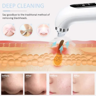 2023 Blackhead Remover Pore Vacuum Cleaner Electric Micro Small Bubble Facial Cleasing Machine USB Rechargeable Beauty Device 4