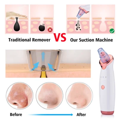Electric Facial Blackhead Remover Vacuum Pore Cleaner Acne Cleanser Black Spots Removal Face Nose Deep Cleaning tools 2